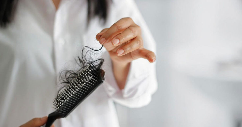 Conditions Hair Loss